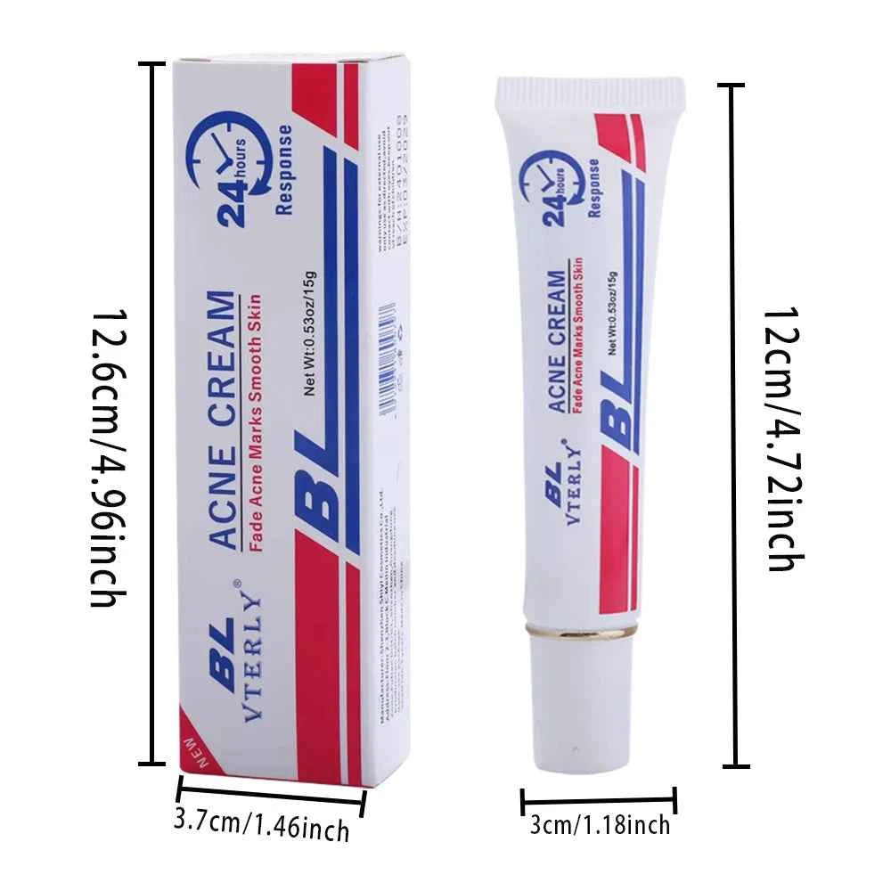 Acne Cream Scar Treatment Fast Acting - 24-Hour Spot Reduction, Anti Acne Formula, Sensitive Skin Safe, Includes Rapid Acne Scar Removal, Moisturiser, Deep Pore Cleansing - 15g - JUCE