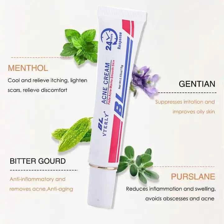 Acne Cream Scar Treatment Fast Acting - 24-Hour Spot Reduction, Anti Acne Formula, Sensitive Skin Safe, Includes Rapid Acne Scar Removal, Moisturiser, Deep Pore Cleansing - 15g - JUCE
